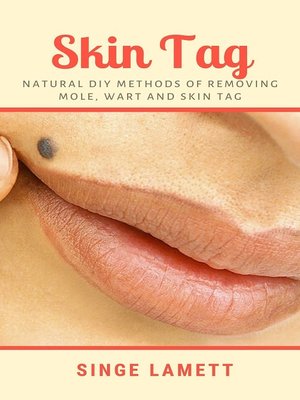 cover image of Skin Tag